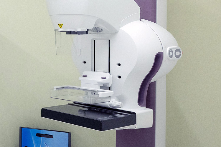 マンモグラフィ